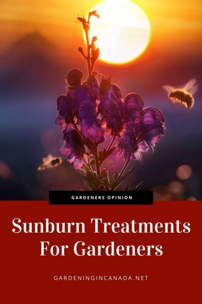 Sunburn treatments for gardeners